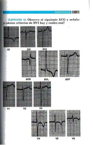 La alegria de leer electrocardiograma