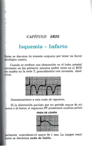 La alegria de leer electrocardiograma