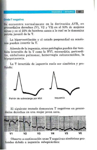 La alegria de leer electrocardiograma