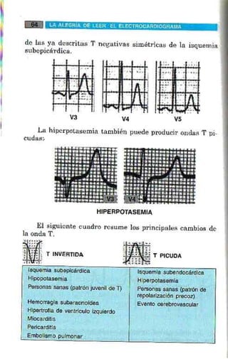 La alegria de leer electrocardiograma