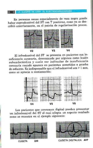 La alegria de leer electrocardiograma