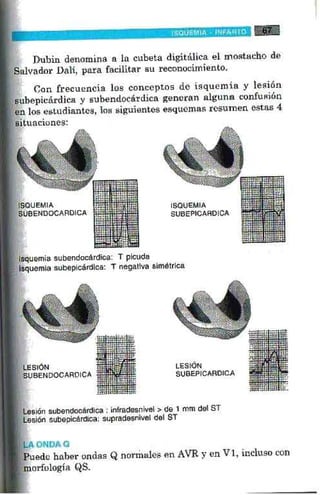 La alegria de leer electrocardiograma
