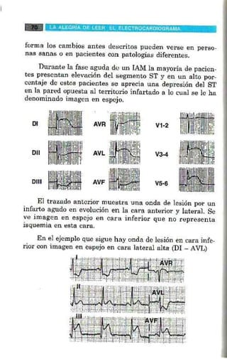La alegria de leer electrocardiograma