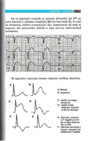 La alegria de leer electrocardiograma