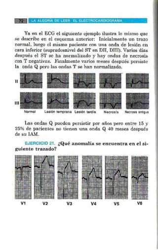 La alegria de leer electrocardiograma