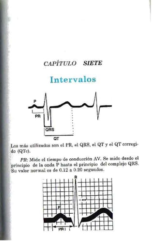 La alegria de leer electrocardiograma