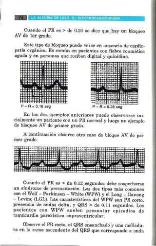 La alegria de leer electrocardiograma