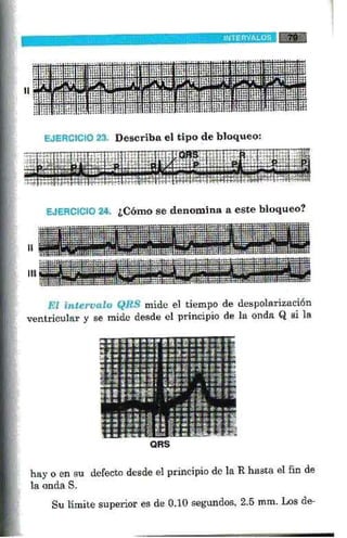 La alegria de leer electrocardiograma