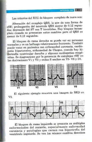 La alegria de leer electrocardiograma