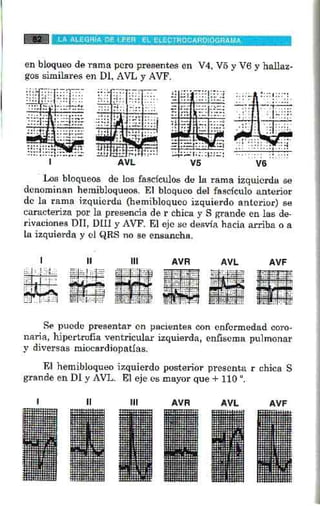 La alegria de leer electrocardiograma