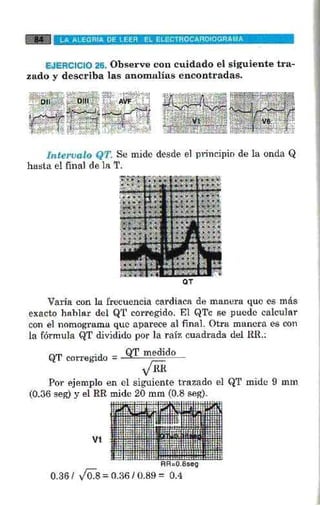 La alegria de leer electrocardiograma
