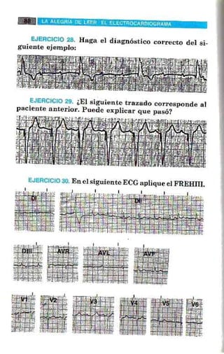 La alegria de leer electrocardiograma