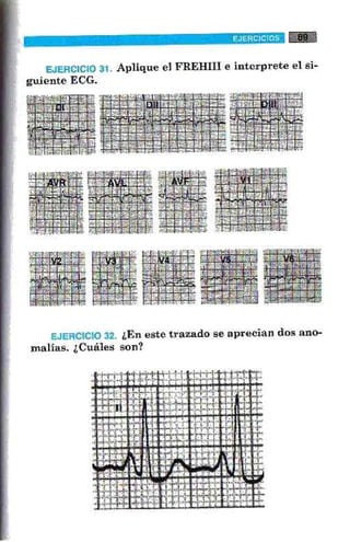 La alegria de leer electrocardiograma