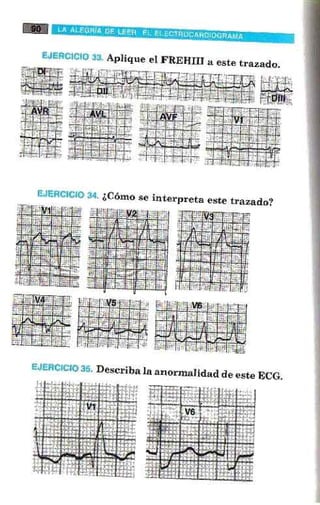 La alegria de leer electrocardiograma