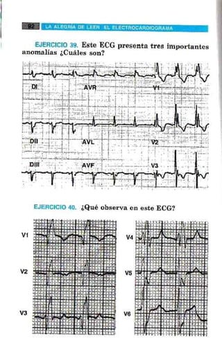 La alegria de leer electrocardiograma