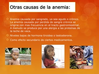  Anemia causada por sangrado, ya sea agudo o crónico. 
La anemia causada por perdida de sangre crónica se 
origina con mas frecuencia en el tracto gastrointestinal. 
A menudo se produce por una alergia a las proteínas de 
la leche de vaca. 
 Niveles bajos de hormona tiroidea o testosterona. 
 Como efecto secundario de ciertos medicamentos. 
 