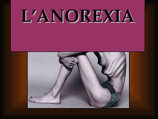 L’ANOREXIA 