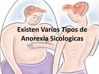 Existen Varios Tipos de Anorexia Sicologicas