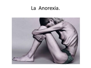 La Anorexia.
 