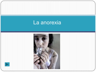La anorexia
 
