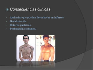    Consecuencias clínicas

•   Arritmias que pueden desenbocar en infartos.
•   Desidratación.
•   Roturas gastricas.
•   Perforación esofágica.
 