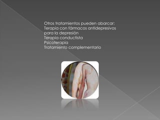Otros tratamientos pueden abarcar:Terapia con fármacos antidepresivos para la depresión Terapia conductista Psicoterapia Tratamiento complementario 