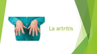 La artritis
 