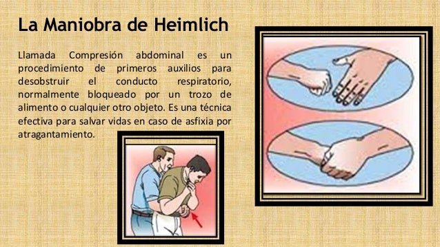 asfixia interno asfixia interno