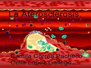 La Ateroscerosis. Camila Correa Pacheco Y Celia López Gallego. 