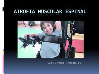 ATROFIA MUSCULAR ESPINAL
Daniel Bermejo Hernández. 3ºE
 