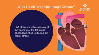 Laa Closure Algorithm LAA Watchman | PPTX