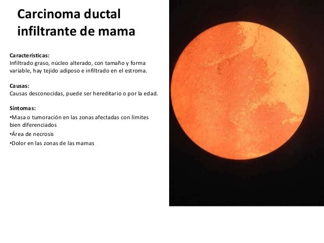 Porque La Luz Se Ve Afectada Por La Gravedad