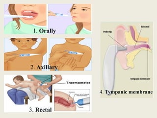 1. Orally
2. Axillary
3. Rectal
4. Tympanic membrane
 