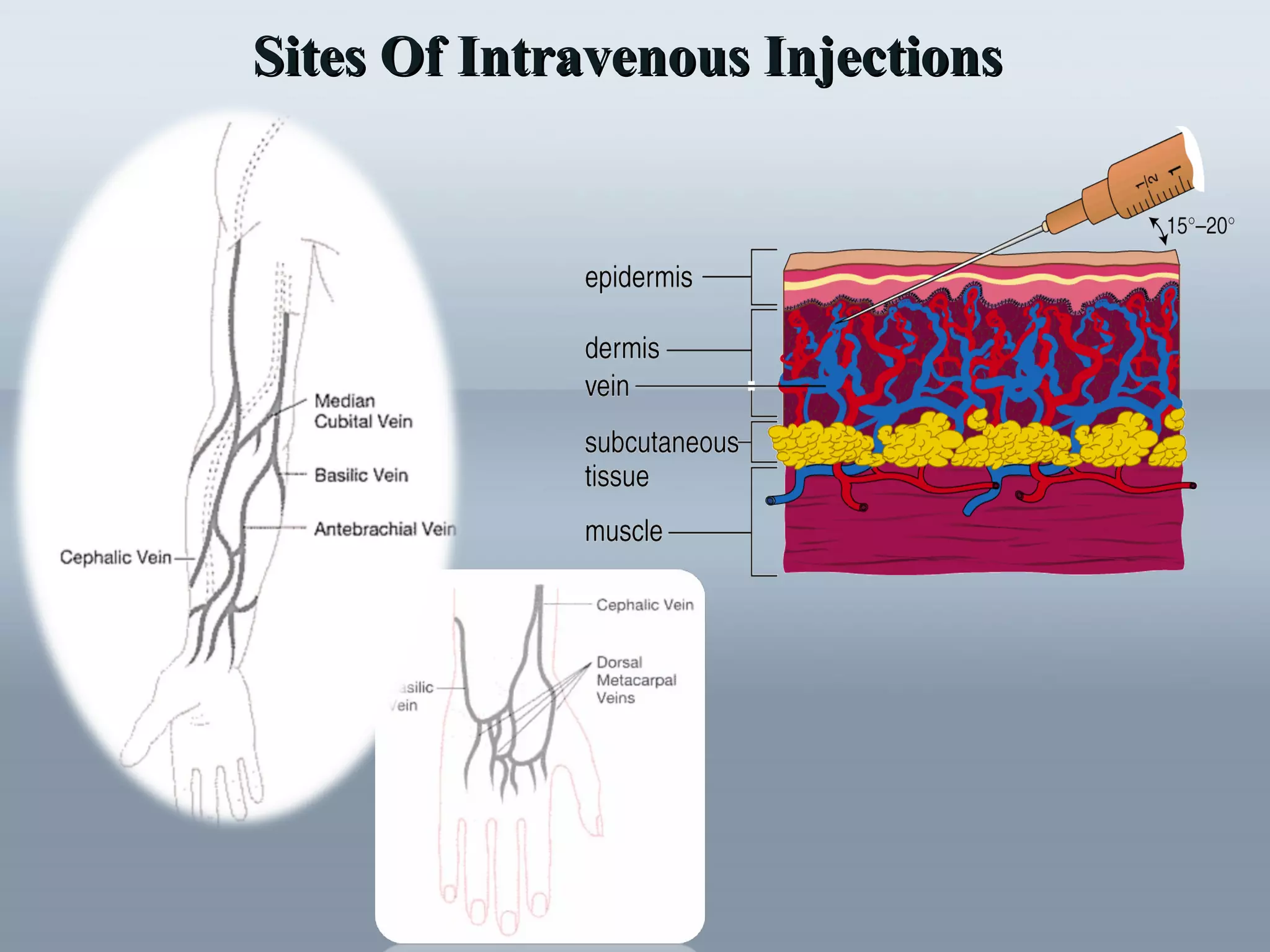 Sites Of Intravenous InjectionsSites Of Intravenous Injections
 