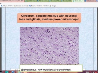 December 30, 201681
Spontanenous new mutations are uncommon.
 