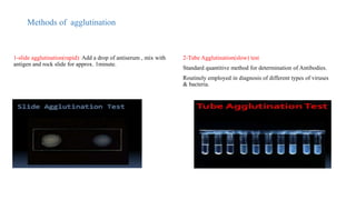 Comprehensive Overview of Immunological Laboratory Diagnosis and ...