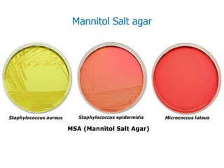 Mannitol Salt agar
 