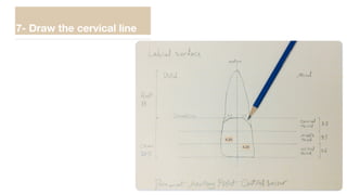 7- Draw the cervical line
4.25
4.25
 
