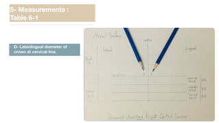 • D- Labiolingual diameter of
crown at cervical line.
5- Measurements :
Table 6-1
 