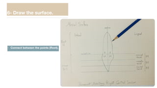 6- Draw the surface.
• Connect between the points (Root).
 