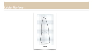 Labial Surface
 
