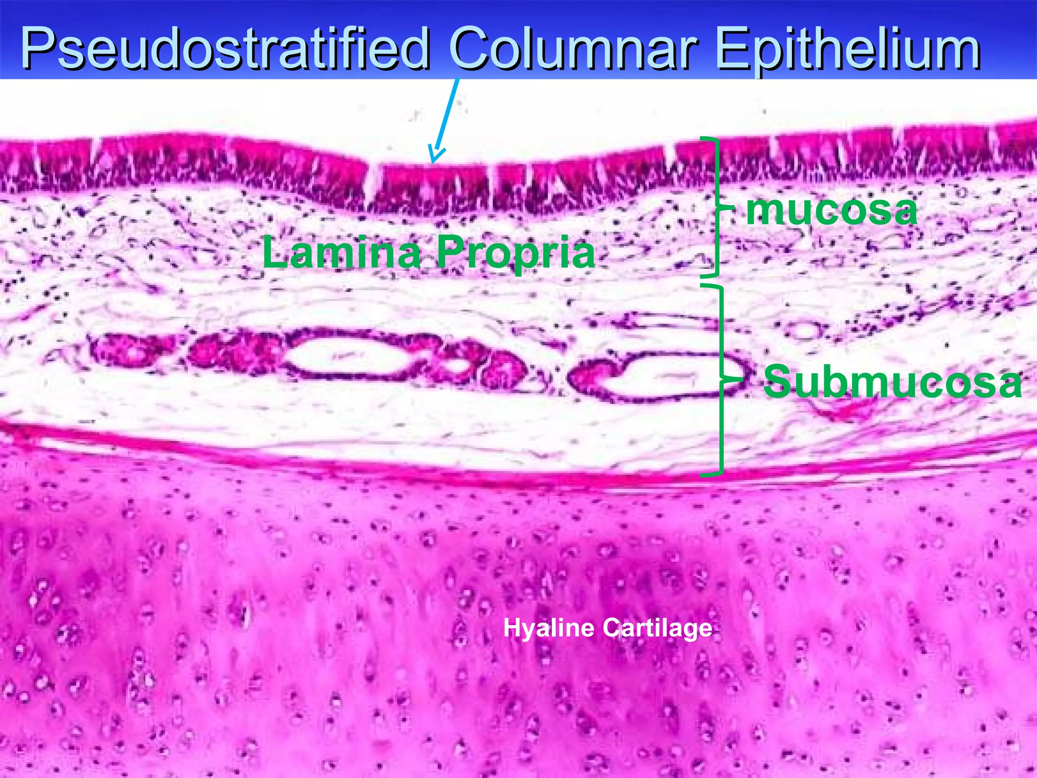Pseudostratified Columnar Epithelium Lamina Propria Hyaline Cartilage mucosa Submucosa 