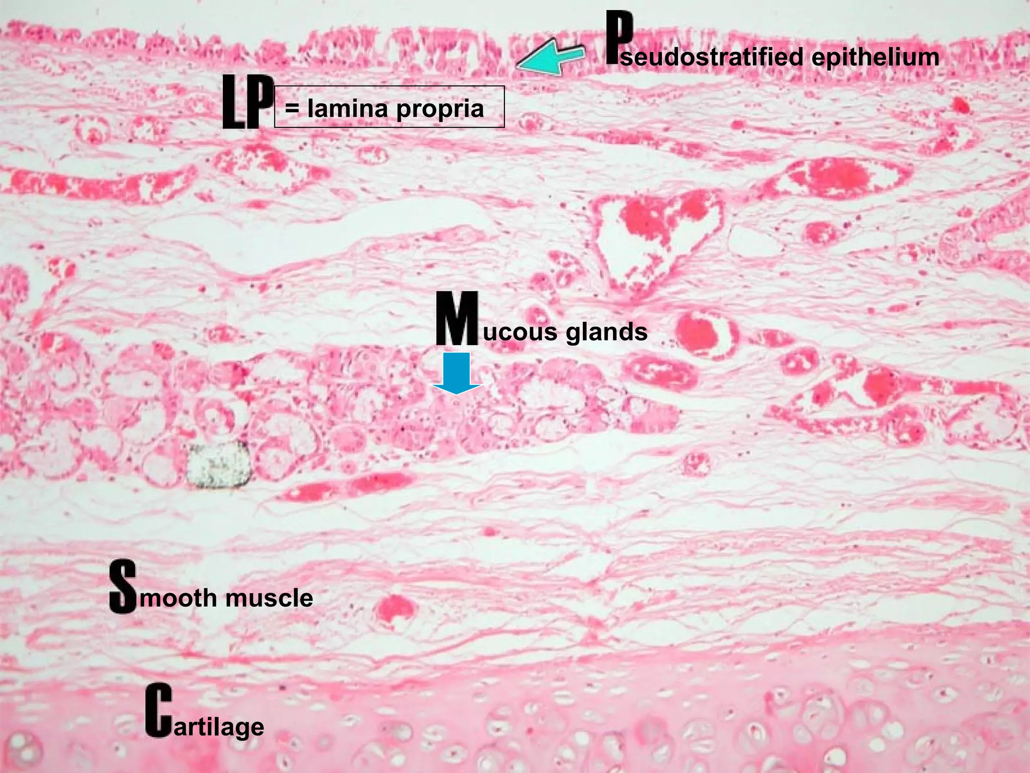 seudostratified epithelium = lamina propria ucous glands mooth muscle artilage 