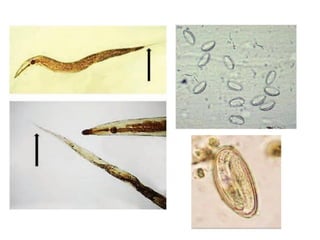 Overview of Intestinal Nematodes: Types, Life Cycle, and Diseases | PDF