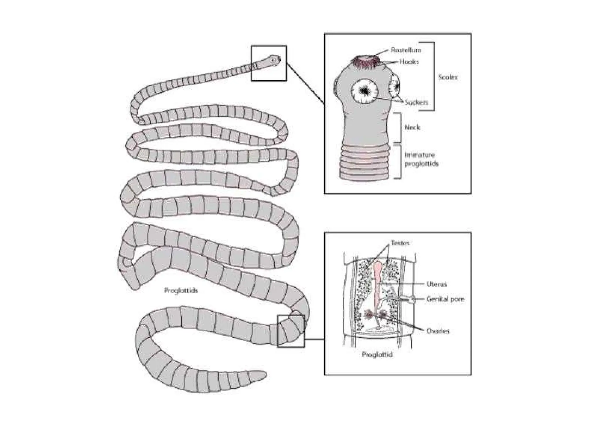 “Overview of Intestinal Cestodes: Types, Life Cycle, and Diseases” | PDF