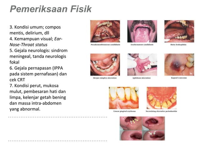 Lab 1 - Pemeriksaan fisik dan diagnostic pasien HIV:AIDS.pptx