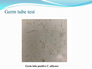 Germ tube test
Germ tube positive C. albicans
 