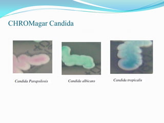 CHROMagar Candida
 