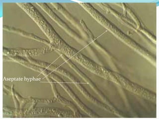 Aseptate hyphae
 