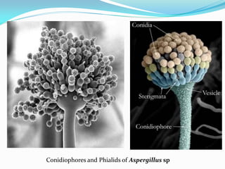 Conidiophores and Phialids of Aspergillus sp
 